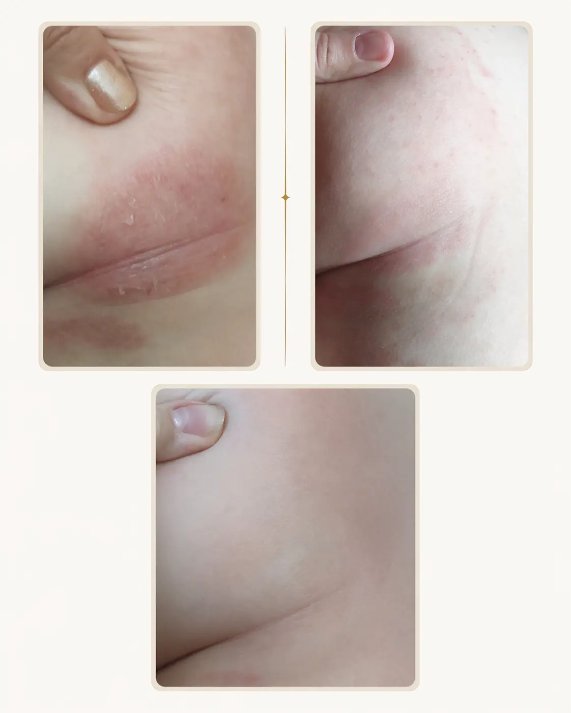 Artem — child skin condition cleared